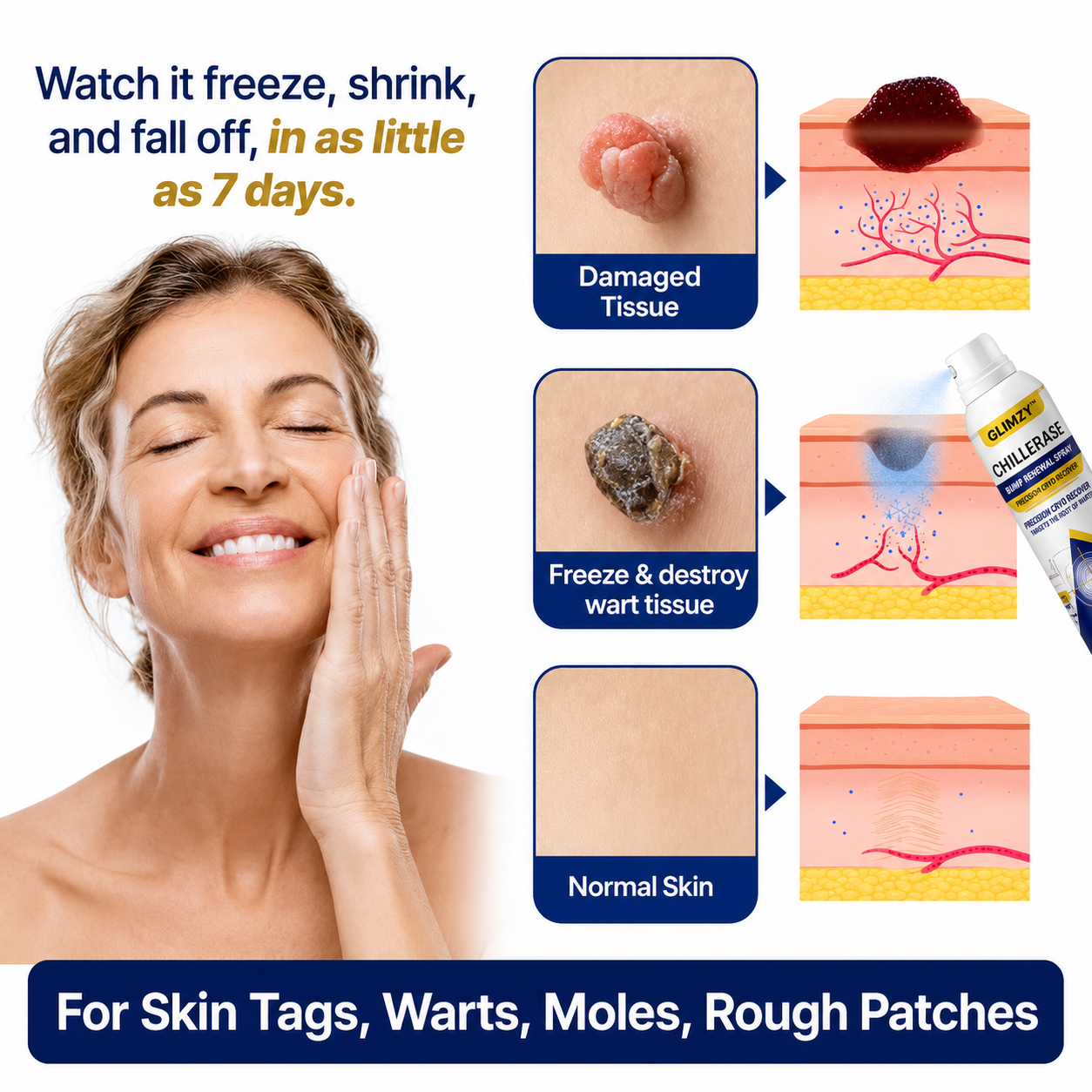 Glimzy Skin-Tag Renewal Spray